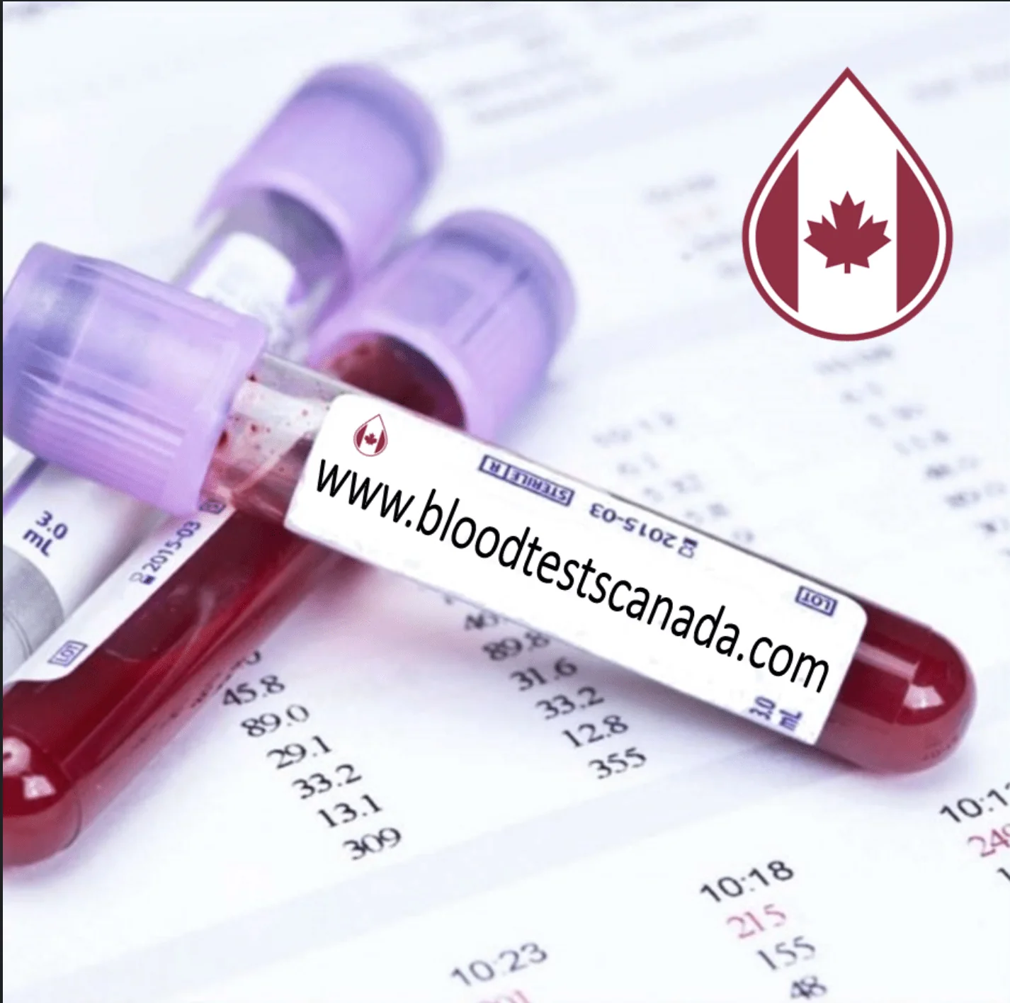 C-Telopeptide (Crosslaps) Serum