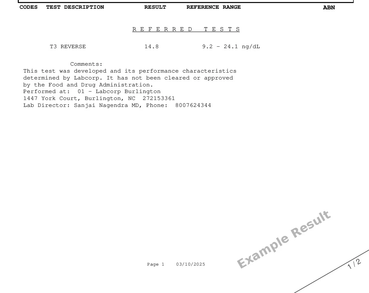 Reverse T3 - Image 2